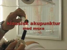 Klassisk akupunktur med Moxa